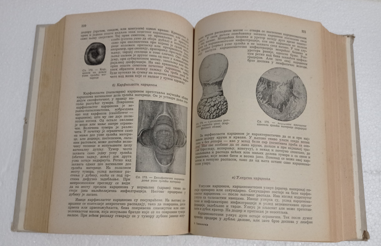 GINEKOLOGIJA Svetislav Barjaktarović medicina udžbenik