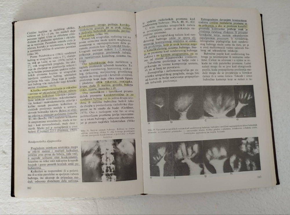 Klinička Rendgenologija Urinarnog Sistema Goldner Panić medicina